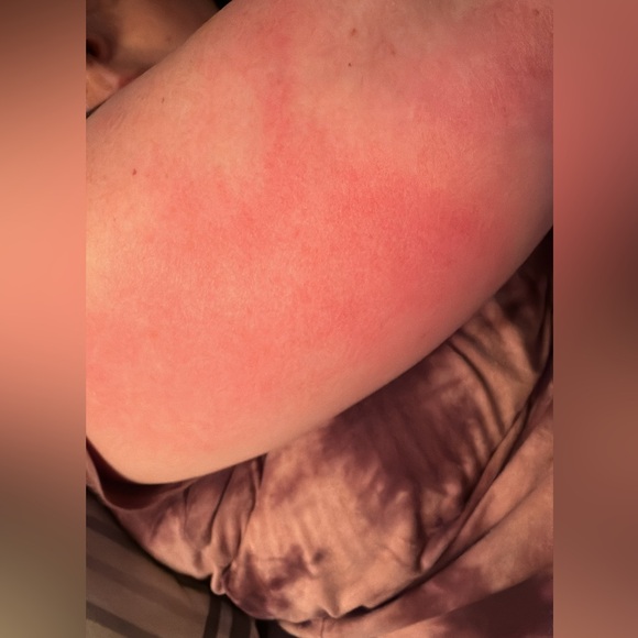 Your purchases help me while i try to get disability for a rare brain disease - Picture 5 of 10